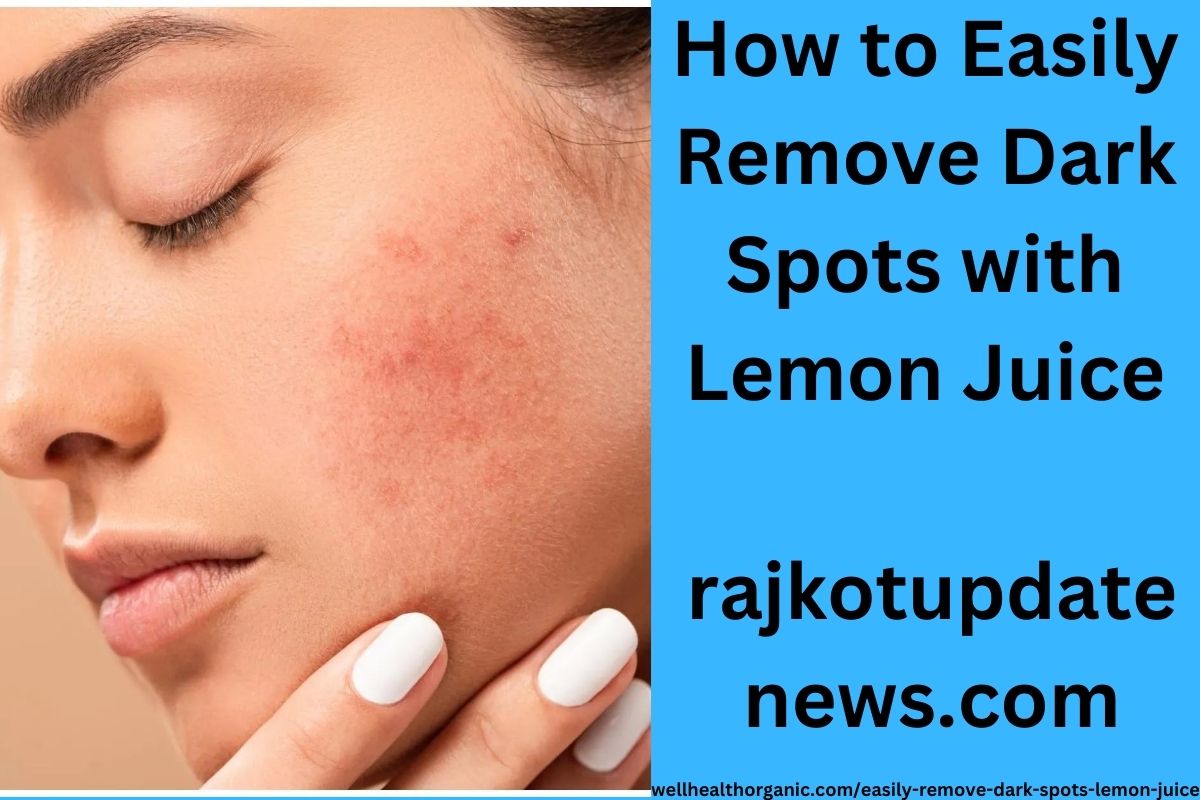 How to Easily Remove Dark Spots with Lemon Juice